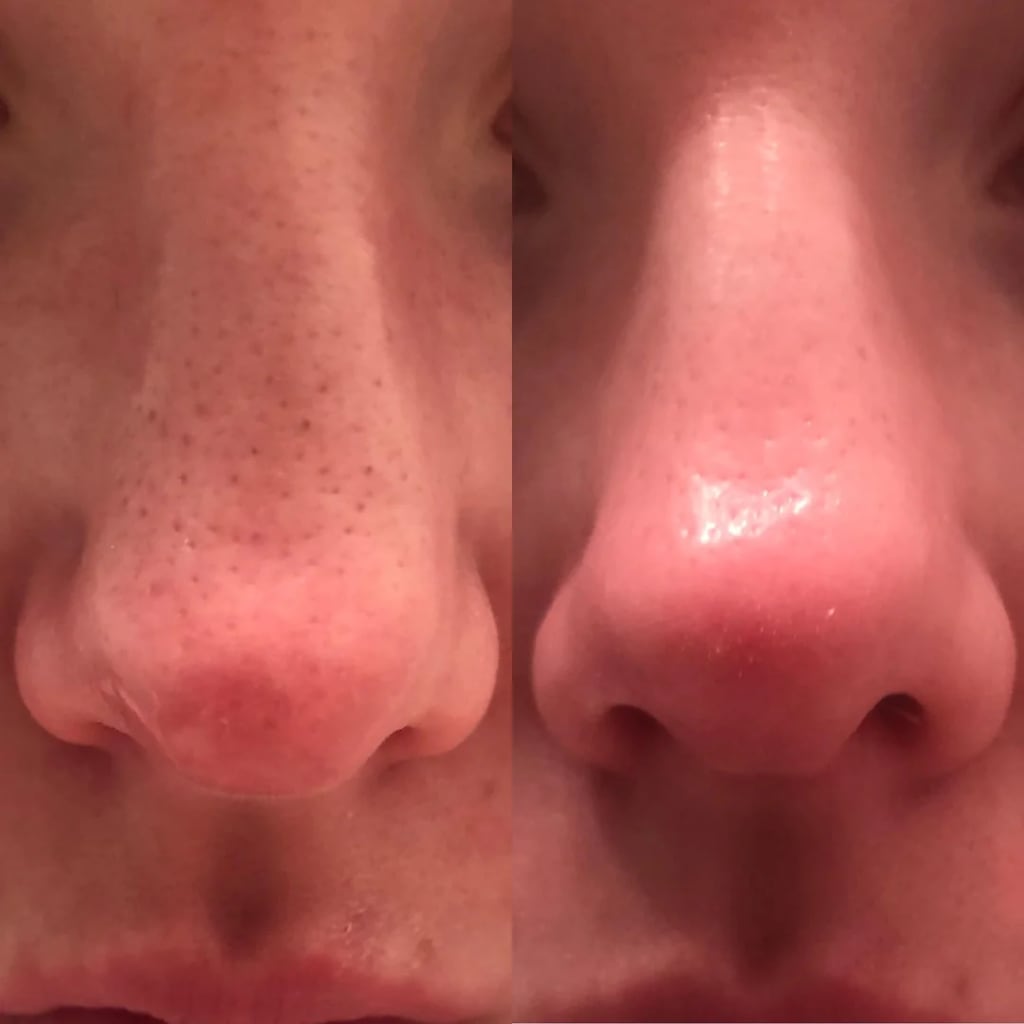 Dr. Melaxin™️ 30 days Transformation Kit (7 pc set)