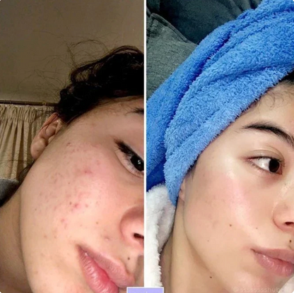 Dr. Melaxin™️ 30 days Transformation Kit (7 pc set)