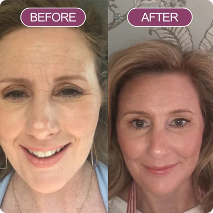 Dr. Melaxin™️ 30 days Transformation Kit (7 pc set)